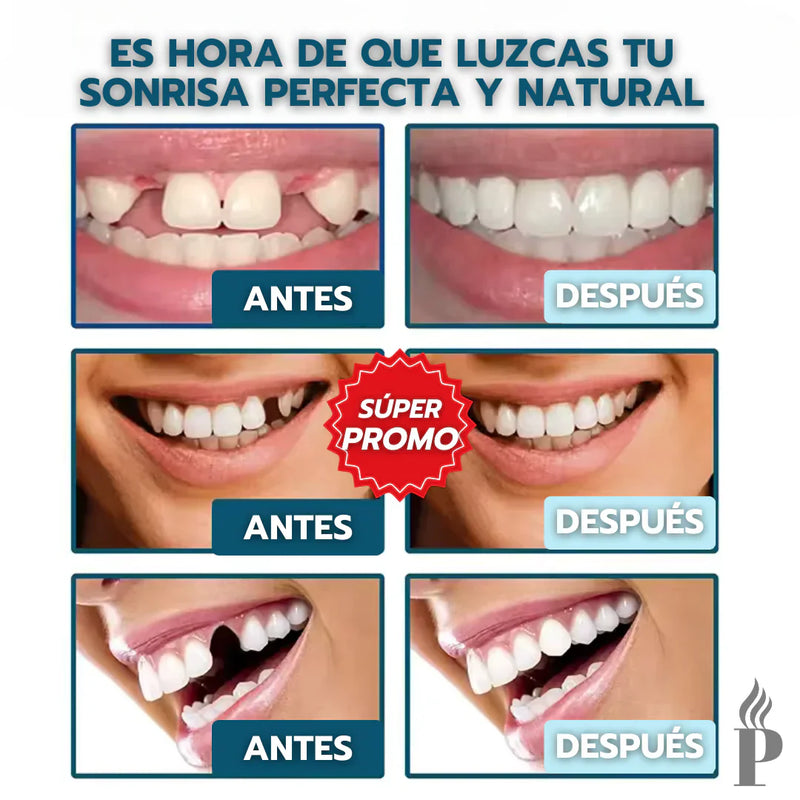 💥SmileLuxe PRO 2025|✨EL SECRETO PARA UNA SONRISA PERFECTA EN 10 SEGUNDOS: SIN DENTISTA Y SIN GASTAR UNA FORTUNA.👉PAGA 1 Y RECIBE 2😁