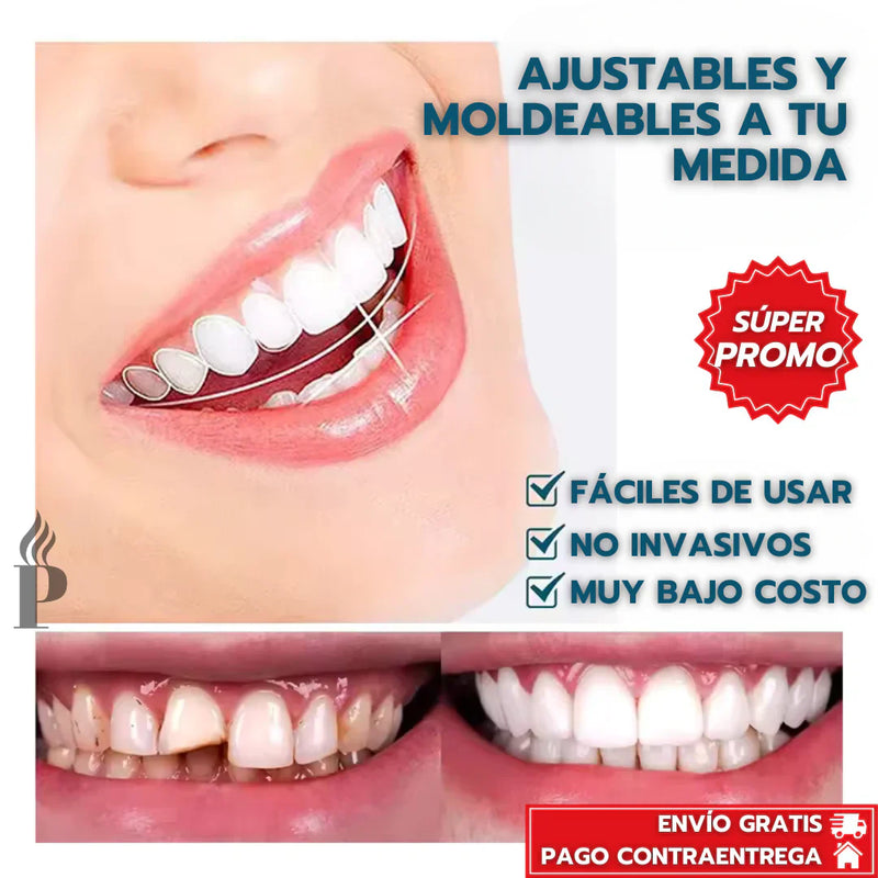 💥SmileLuxe PRO 2025|✨EL SECRETO PARA UNA SONRISA PERFECTA EN 10 SEGUNDOS: SIN DENTISTA Y SIN GASTAR UNA FORTUNA.👉PAGA 1 Y RECIBE 2😁